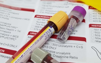 The Importance of blood testing